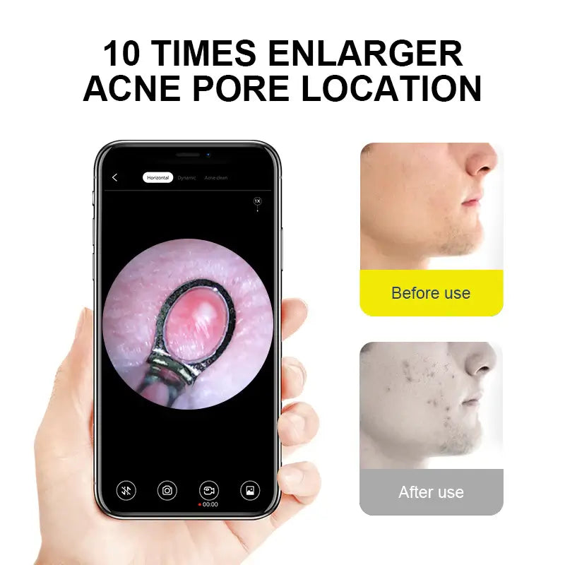Ear Wax Removal Tool with WiFi & 1080P HD Camera, Wireless Ear Wax Cleaner with 6 LED Light for Kids Adults Pets (New Version) - Imported from UK