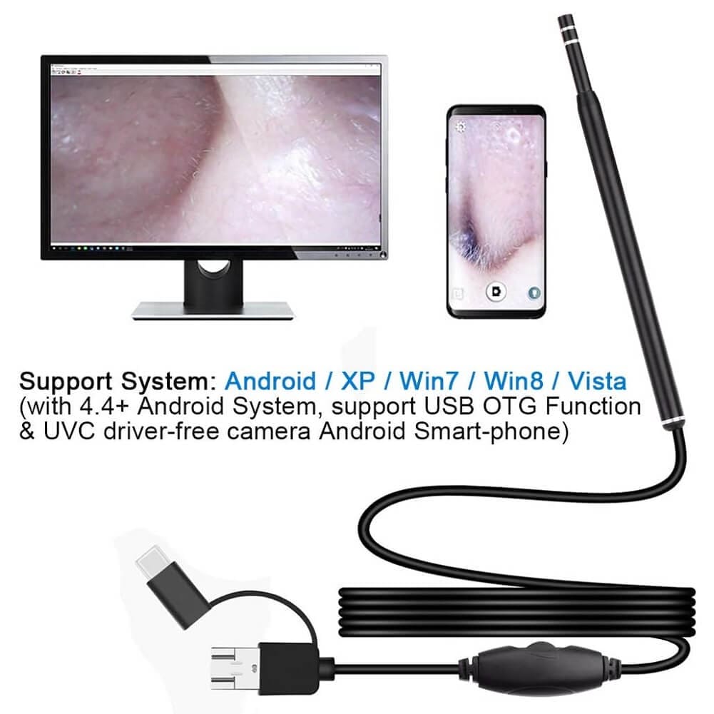 Ear Wax Removal Kit, 3-in-1 5.5mm USB HD Ear Cleaner Endoscope/Otoscope with 6 LED Light, Visual Ear Camera for Adults Kids Pets - Imported from UK