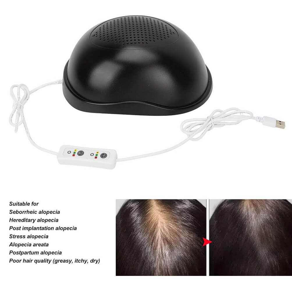 Hair Growth Helmet with 312 Lamp Beads Anti Hair Loss Hat, Red Light Therapy Hair Generator, USB Interface - (Container Product Without Box) - Imported from UK