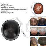 Hair Growth Helmet with 312 Lamp Beads Anti Hair Loss Hat, Red Light Therapy Hair Generator, USB Interface - (Container Product Without Box) - Imported from UK