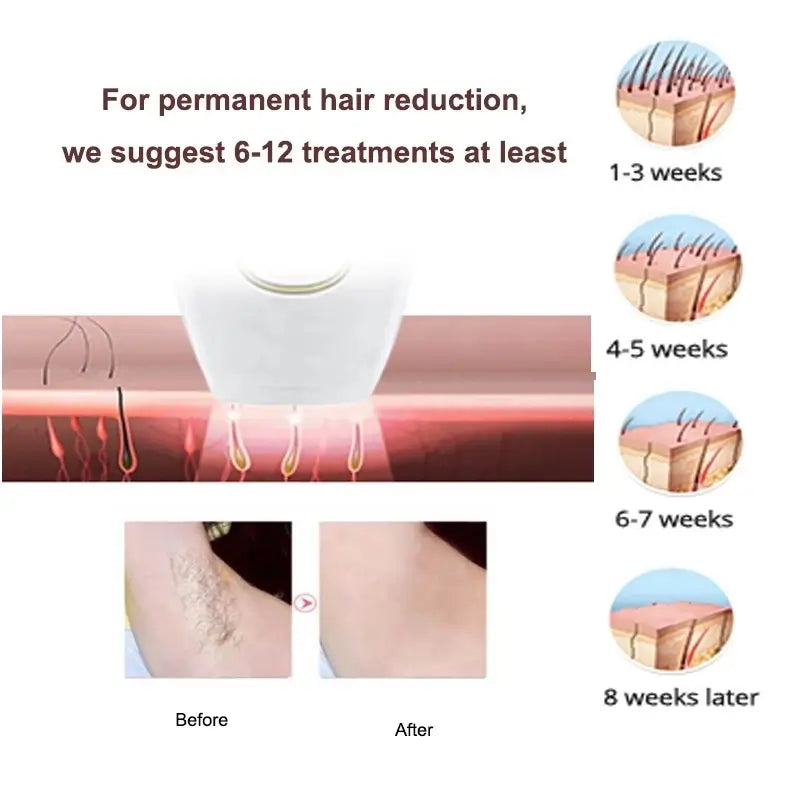 IPL Permanent Laser Hair Remover with 5 Energy Level, 500,000 Flashes for Women & Men for Facial Legs Arms Whole Body - Imported from UK