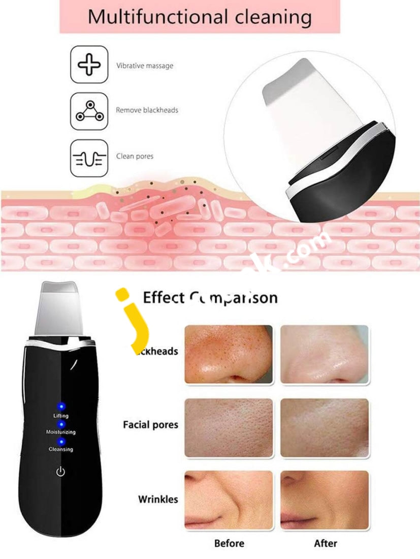 Ultrasonic Skin Scrubber Spatula Rechargeable Facial Cleaner Peeling Vibration Blackhead Removal