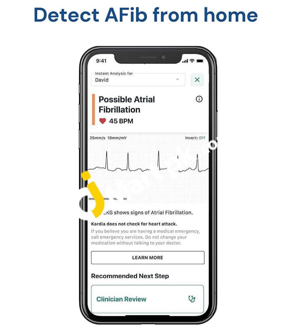 Alivecor Kardiamobile Single Lead Personal Ekg Monitor Detects Afib & Irregular Arrhythmias Instant