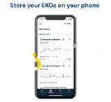 Alivecor Kardiamobile Single Lead Personal Ekg Monitor Detects Afib & Irregular Arrhythmias Instant