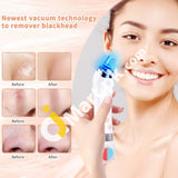 Blackhead Remover Usb Rechargeable Vacuum Pore Professional Cleaner With 5 Adjustable Suction Power