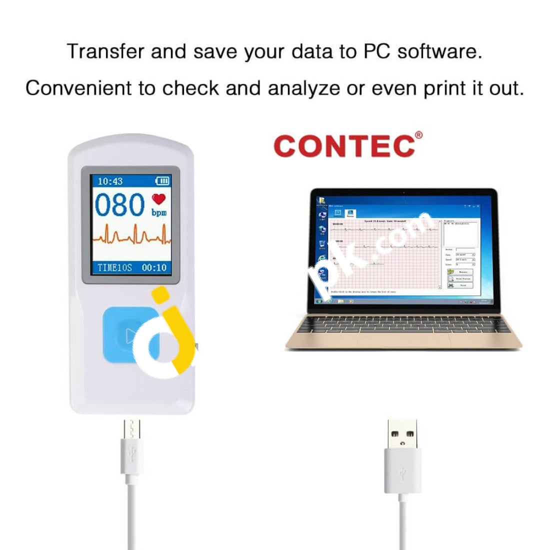 Contec Portable Ecg/Ekg Monitor Pc Software Electrocardiogram Cloud Bluetooth Heart Beat Rate Lcd -