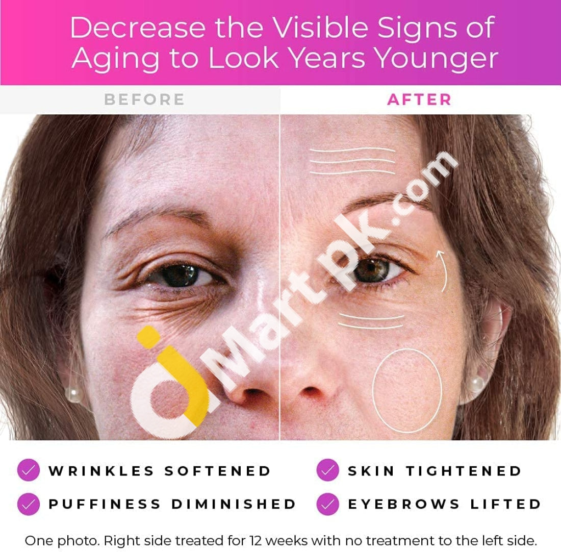 Dermawand Radio Frequency And Microcurrent Anti-Aging Device Reduce The Appearance Of Fine Lines