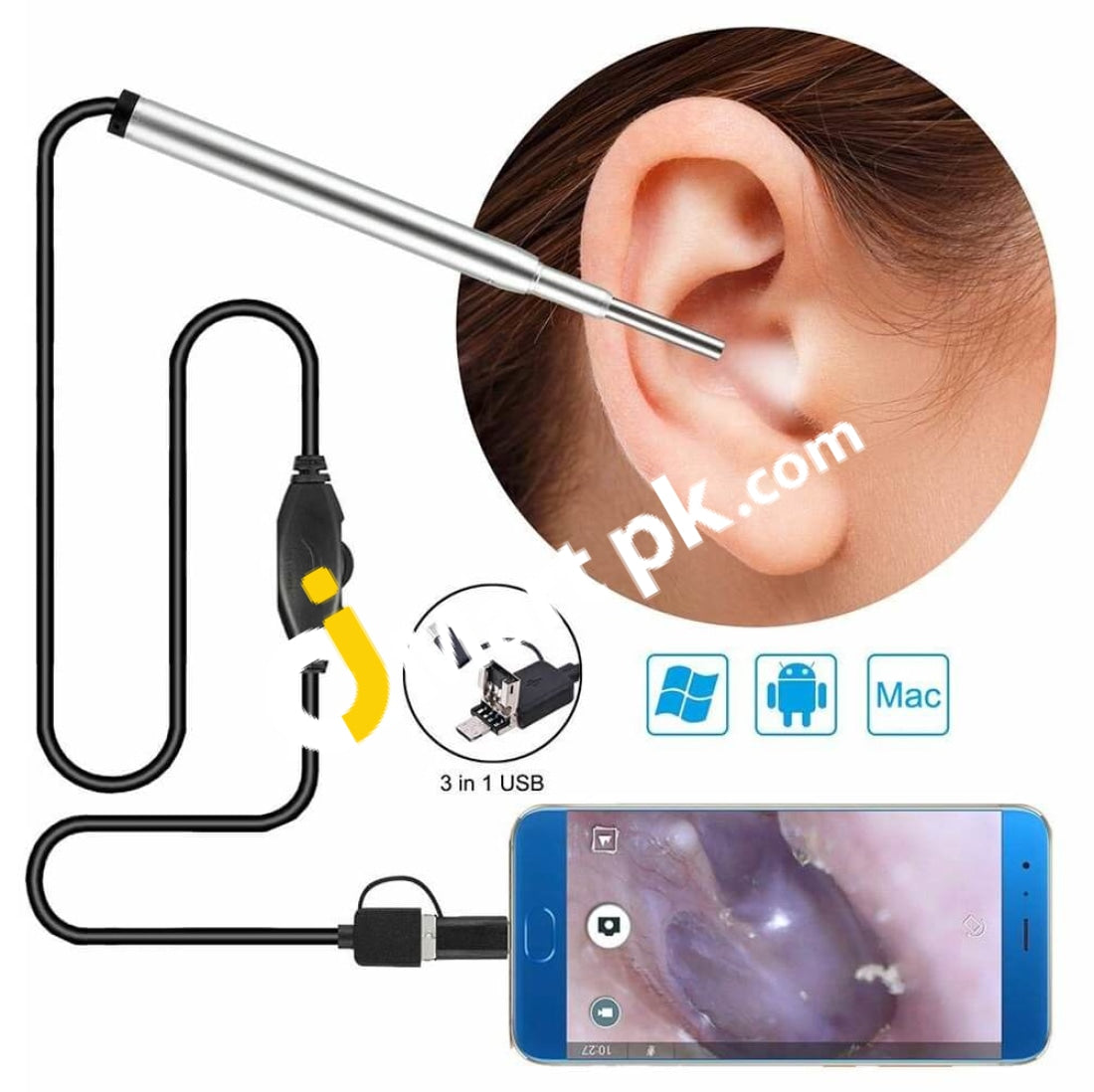 Ear Cleaning Endoscope With Mini Hd Visual Camera 3.9Mm 3-In-1 Usb Removal Tool - Imported From Uk