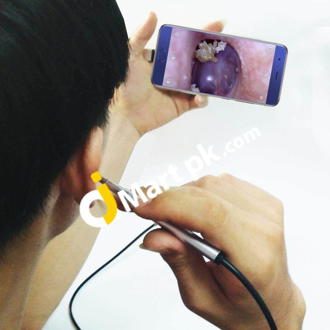 Ear Cleaning Endoscope With Mini Hd Visual Camera 3.9Mm 3-In-1 Usb Removal Tool - Imported From Uk