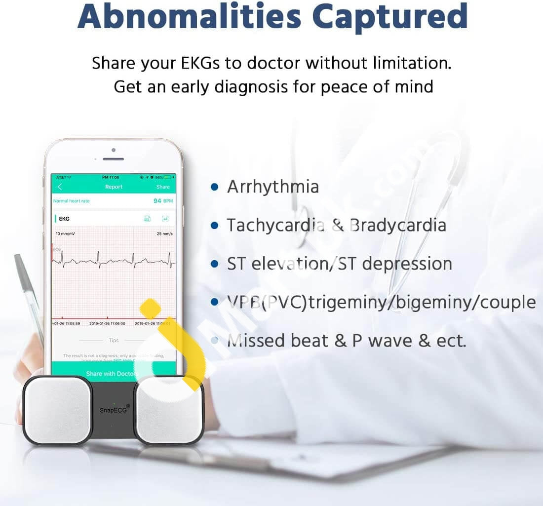 Snapecg Handheld Ecg Heart Rate Monitors Imported From Uk