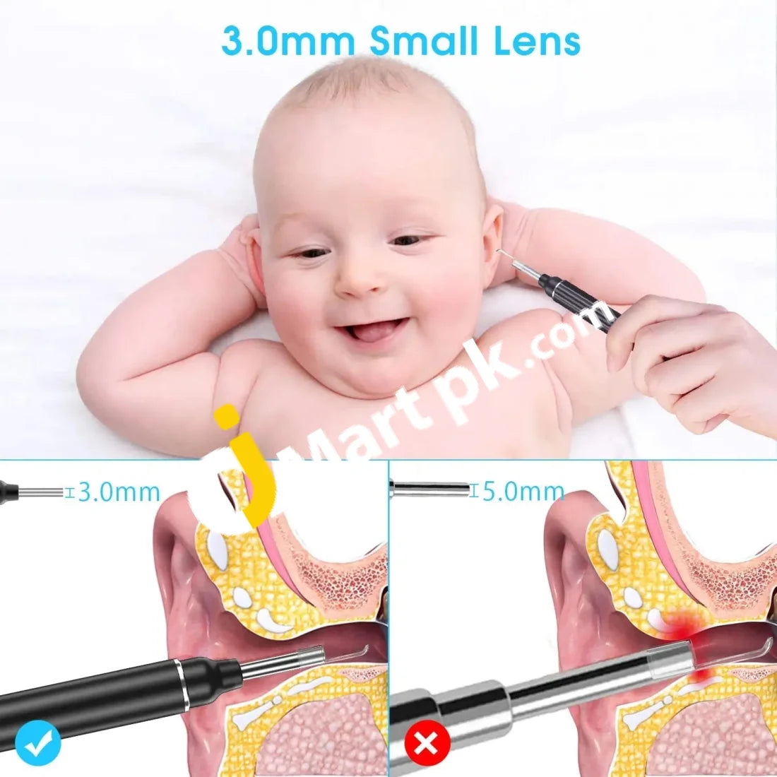 Vitcoco Ear Wax Removal Kit 1926P Fhd Wifi Wireless Otoscope With Led Lights 3Mm Mini Visual