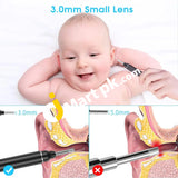 Vitcoco Ear Wax Removal Kit 1926P Fhd Wifi Wireless Otoscope With Led Lights 3Mm Mini Visual