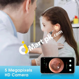 Vitcoco Ear Wax Removal Kit 1926P Fhd Wifi Wireless Otoscope With Led Lights 3Mm Mini Visual