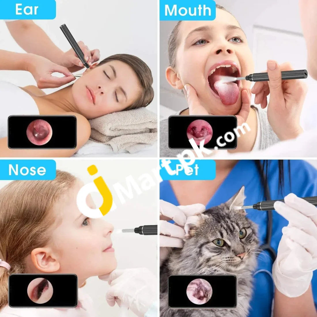 Vitcoco Ear Wax Removal Kit 1926P Fhd Wifi Wireless Otoscope With Led Lights 3Mm Mini Visual