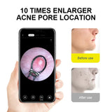Ear Wax Removal Tool with WiFi & 1080P HD Camera, Wireless Ear Wax Cleaner with 6 LED Light for Kids Adults Pets (New Version) - Imported from UK