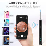 Ear Wax Removal Tool with WiFi & 1080P HD Camera, Wireless Ear Wax Cleaner with 6 LED Light for Kids Adults Pets (New Version) - Imported from UK