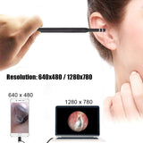Ear Wax Removal Kit, 3-in-1 5.5mm USB HD Ear Cleaner Endoscope/Otoscope with 6 LED Light, Visual Ear Camera for Adults Kids Pets - Imported from UK
