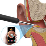 BEBIRD R1 Smart Visual Ear Cleaner, Wax Removal Tool with 1080P Camera with 6 LED Light, Wax Removal Otoscope with Replacement Tips for Ear/Nose/Throat - Imported from UK
