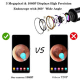 BEBIRD R1 Smart Visual Ear Cleaner, Wax Removal Tool with 1080P Camera with 6 LED Light, Wax Removal Otoscope with Replacement Tips for Ear/Nose/Throat - Imported from UK