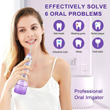 Leominor 300ml Water Flosser, Portable Oral Irrigator with 4 Tips 5 DIY Modes IPX7 Waterproof Rechargeable Water Dental Flosser (Without Box) - Imported from UK