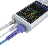 Handheld Vital Signs Monitor, NIBP+SPO2+Temp (3-in-1) 3.5" TFT Color Screen Veterinary Equipment - Imported from UK