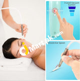 Ear Wax Removal Vacuum Kit Electric Cleaner With 3 Suction Settings For Any Age - Imported From Uk