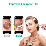 Visual Ear Spoon Endoscope Otoscope With 3.9Mm 720P Camera For Android & Pc - Imported From Uk