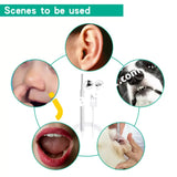 Visual Ear Spoon Endoscope Otoscope With 3.9Mm 720P Camera For Android & Pc - Imported From Uk