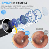 Ear Wax Remover Awelor Wireless Otoscope With 6 Leds Ip67 Waterproof 1296P Hd Wifi Endoscope -