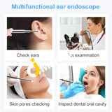 Ear Cleaning Endoscope With Mini Hd Visual Camera 3.9Mm 3-In-1 Usb Removal Tool - Imported From Uk