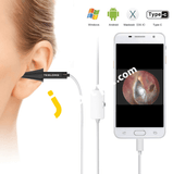 Teslong 3-In-1 Usb Type C Ear Otoscope Inspection Camera With 6 Led Lights - Imported From Uk