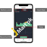 Wellue Viatom Heart Health Monitor Professional Holter Recorder With Ai-Ecg Analysis Report 24-Hours