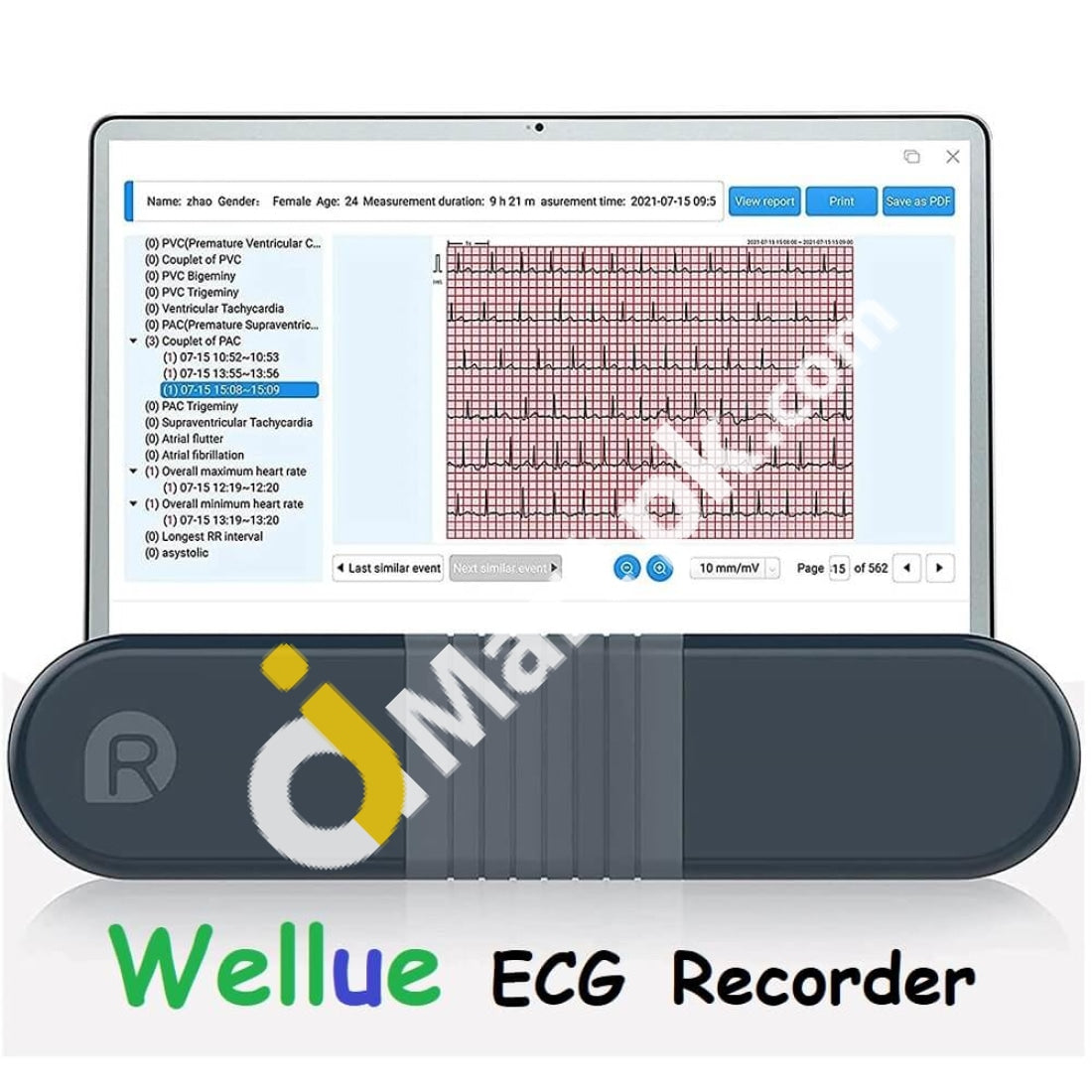 Checkme BP2 Connect Blood Pressure Monitors with AI ECG Analysis, Upper Arm BP  Machine Cuff Kit and EKG Heart Monitor, Supports Wifi & Bluetooth 
