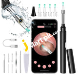 Zupora Ear Camera Wax Removal Kit 1920P Fhd Wireless Otoscope With Led Lights - Imported From Uk