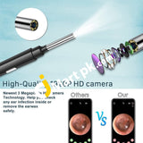 Zupora Ear Camera Wax Removal Kit 1920P Fhd Wireless Otoscope With Led Lights - Imported From Uk