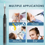 Zupora Ear Camera Wax Removal Kit 1920P Fhd Wireless Otoscope With Led Lights - Imported From Uk